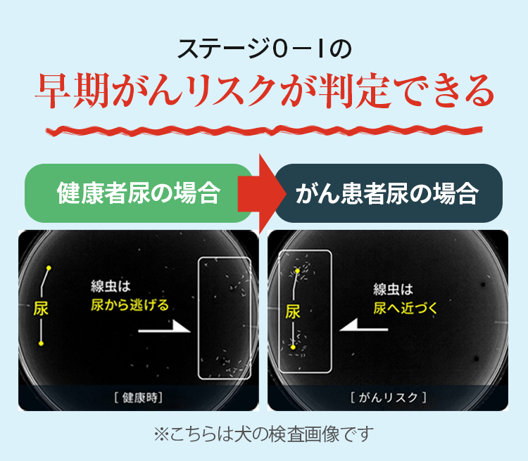 ステージ０－Ⅰの早期がんリスクが判定できる